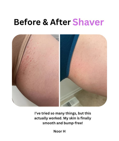 Bikini Dual Hair Shaver
