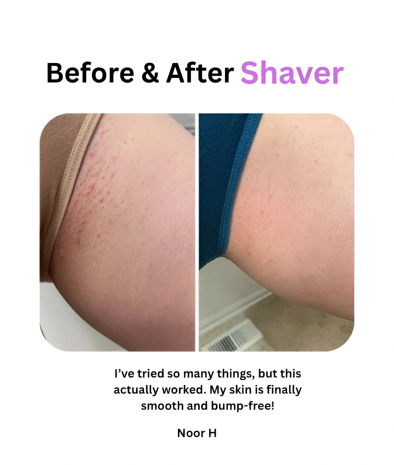 Bikini Dual Hair Shaver