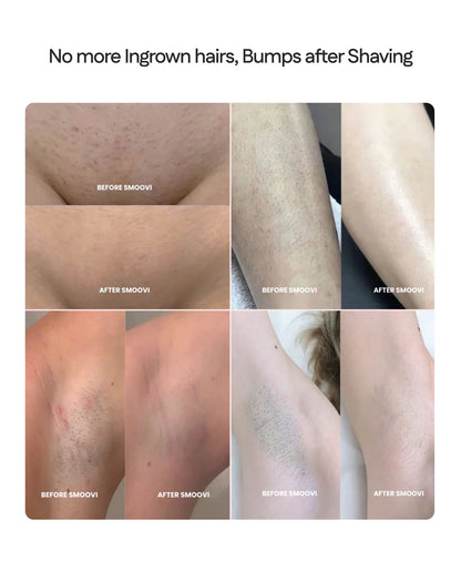Bikini Dual Hair Shaver