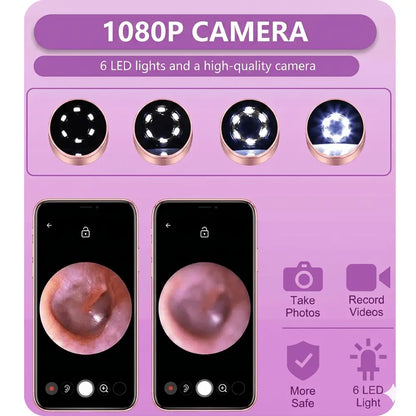 Smart Ear Cleaner with Camera